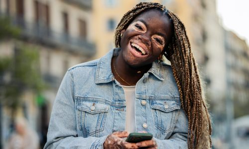 Portrait of a happy, young African American woman with vitiligo enjoying her vacation and using smartphone on the street.